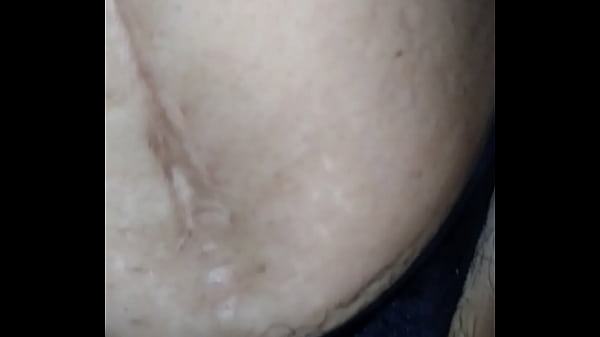 thumb 01