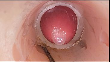 Download Video - The camera in the deep pussy records a huge ejaculation of sperm into the condom