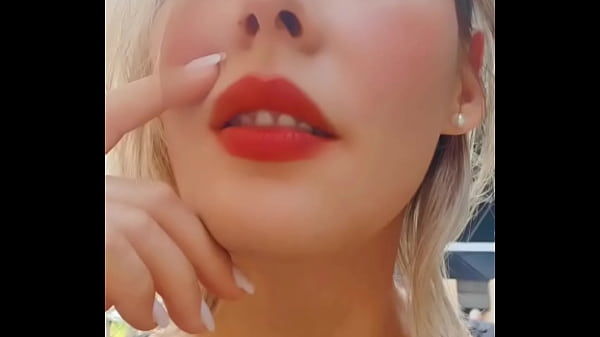 English below Aujourd'hui est un grand jour pour moi ! Après trois ans de traitement, j'ai retiré mon appareil ...