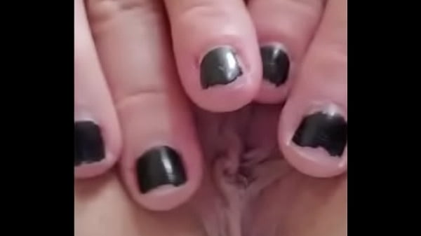 thumb opening up