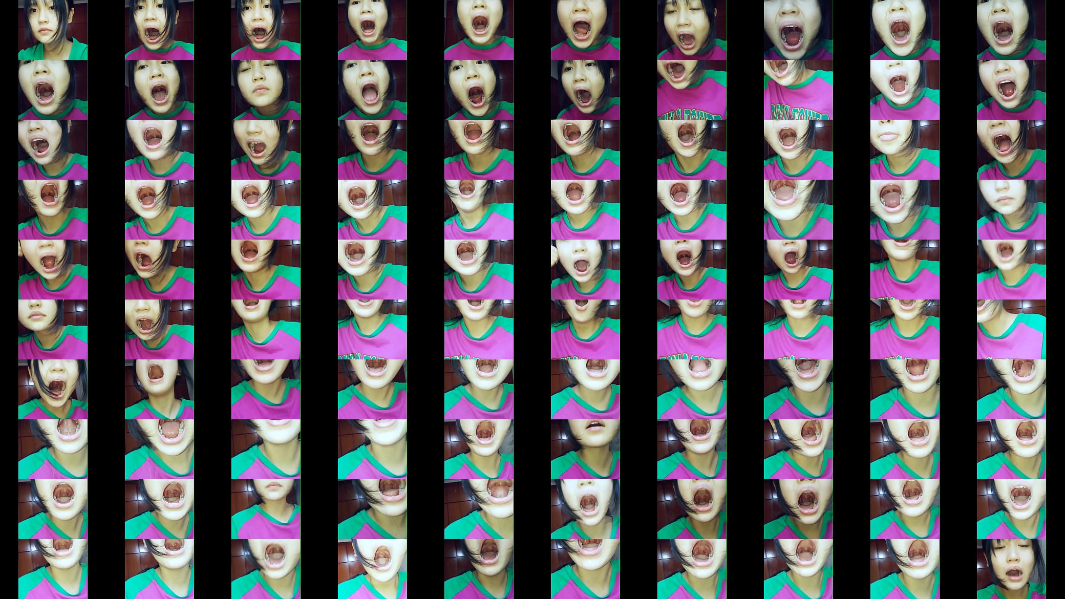 Asian Girl Showing her Teeth Cavities 预览图