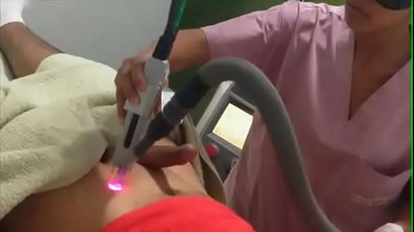 Laser Hair Removal By Indian Nurse