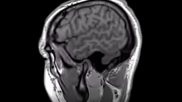 Structural MRI animation