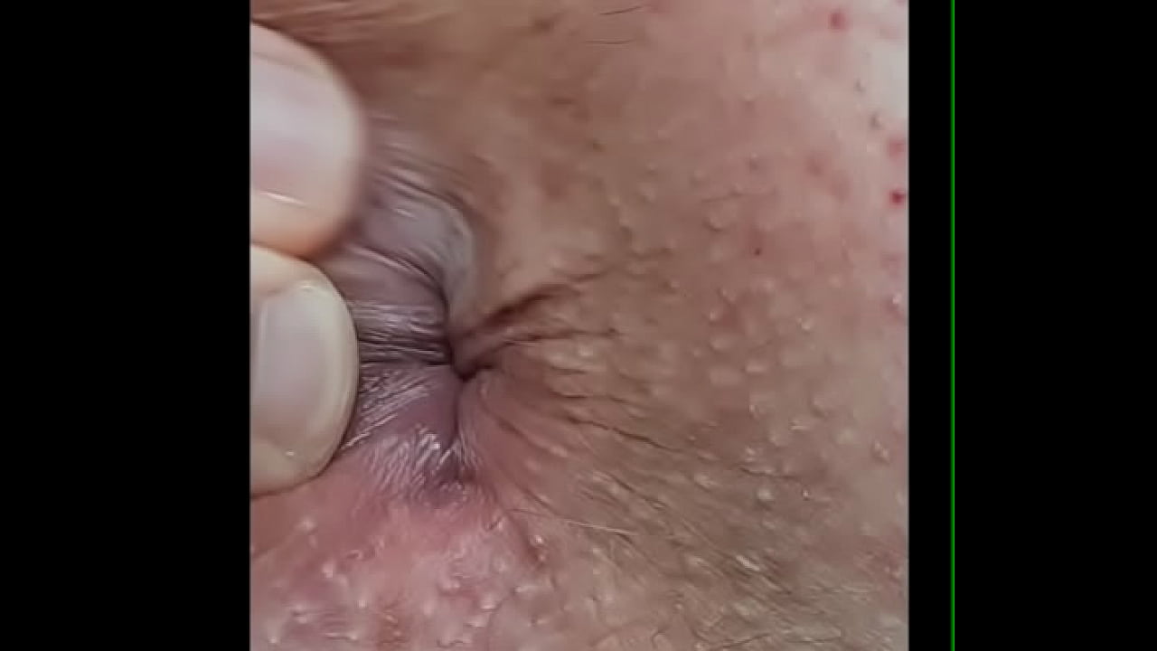 MACRO - Tengo 14 contracciones de orgasmo pulsantes con el culo levantado 1:47 ¡GOLPEANDO ANO VIRGEN!
                   anal ass doggystyle amateur homemade booty solo POV fetish gay older uncensored big cock cumload perfect ass real orgasm solo masturbation circumcised long cock young man fat dick solo boys mature man male anal yummy asshole butt crack real ass private available muchos negros