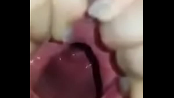 thumb cave