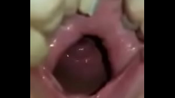 thumb cave