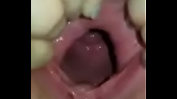 thumb cave