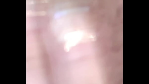 thumb today