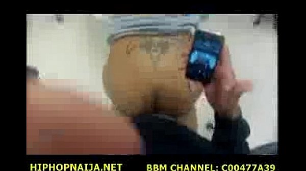thumb ssm