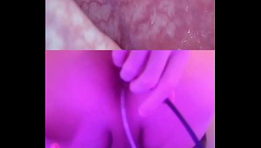Let's take a look with the Endoscope and find out how my ass looks deep inside!