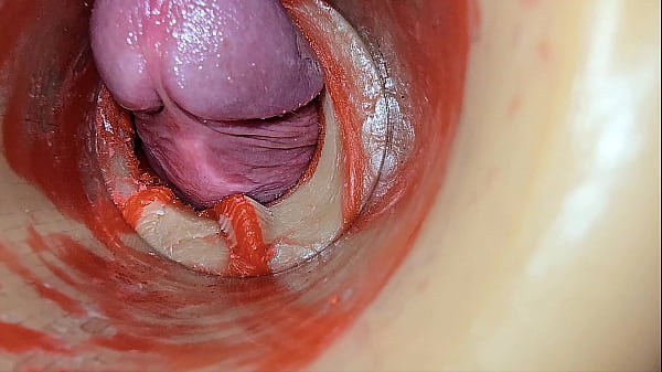 Download Video - Female Insemination - Internal Camera Captures Deep Male Huge Ejaculation