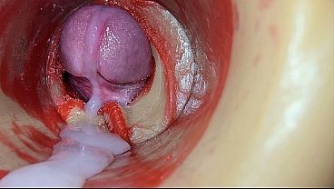 Female Insemination - Internal Camera Captures Deep Male Huge Ejaculation